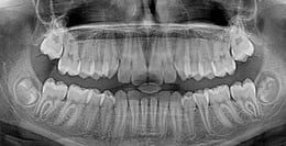 The Dentist