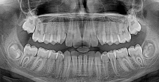 The Dentist